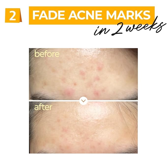 [Numbuzin] No.5 Vitamin Concentrated Serum 30ml – Brightening & Anti-Pigmentation Serum | Authentic Korean Skincare in Pakistan